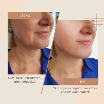 10% Vitamin C+E Super Bright Face Serum | 5% Niacinamide | Brightening & Hydrating Serum for All Skin Types